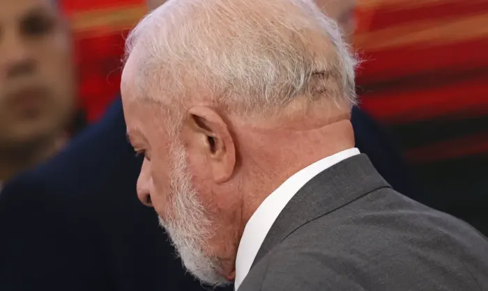 Lula fará novo procedimento médico nesta quinta-feira 12