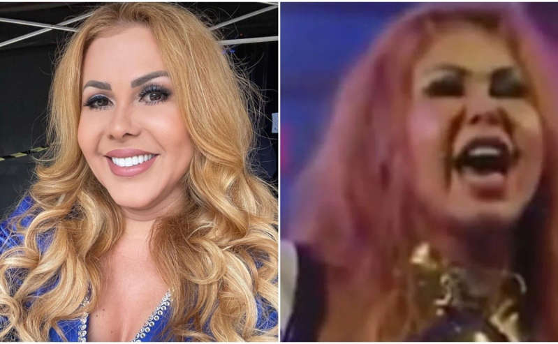 Inchaço facial de Joelma chama a atenção do público em show