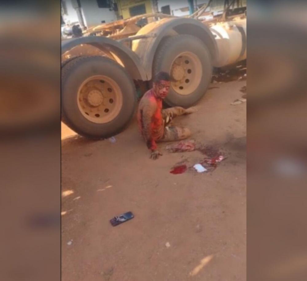 Caminhoneiro atira em colega de profissão em Marabá