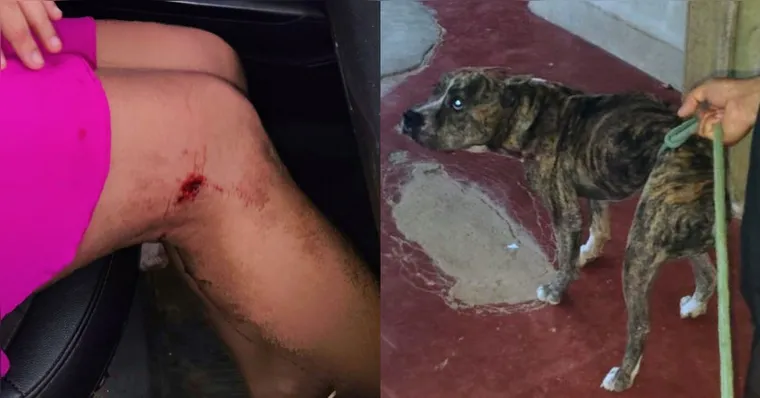 A vítima chegou a ser atacada na perna, mas foi salva pelos policiais | Divulgação
