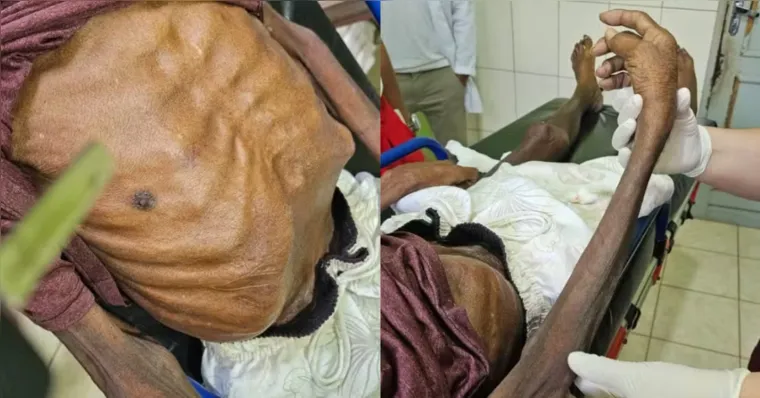Pará: idoso morre e filha é presa por suspeita de maus-tratos
