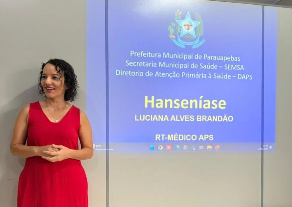 Prefeitura de Parauapebas capacita UBSs para agilizar diagnóstico de hanseníase