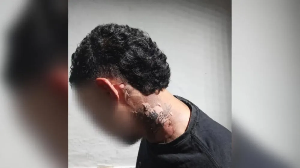 Homem sofre queimaduras após ser atingido por óleo quente em Parauapebas