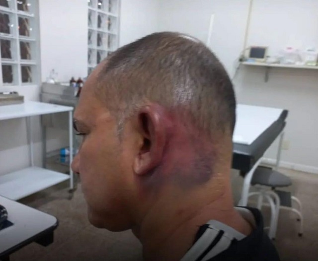 Jornalista acusa prefeito de Tucuruí e seguranças de sequestro e agressão 